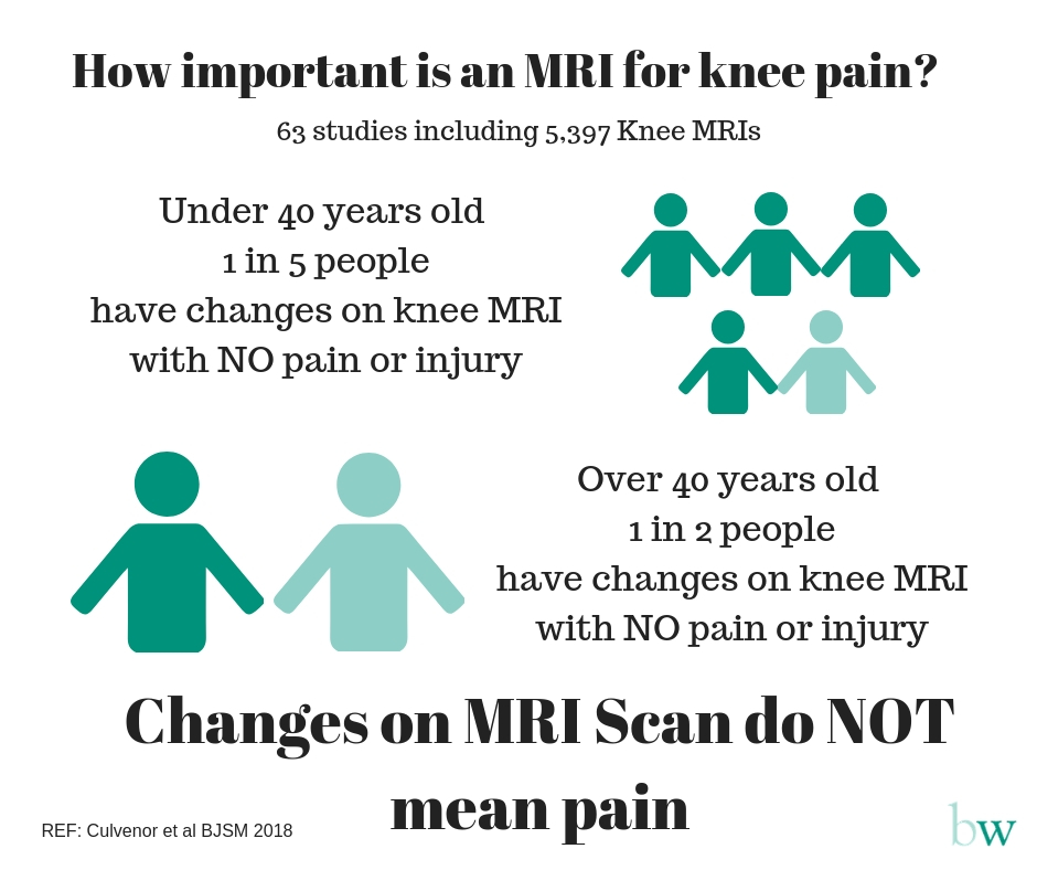 How important is an MRI for knee pain_