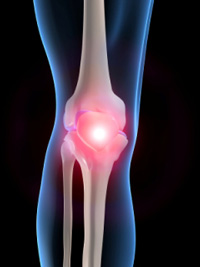 knee pain can be treated with Magnetic Resonance Therapy, physiotherapy and video gait analysis