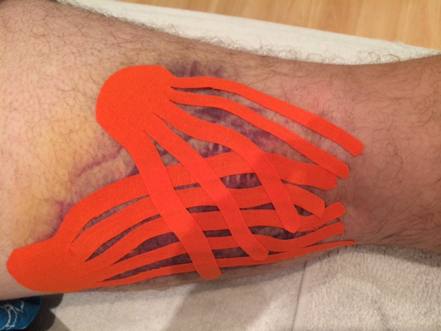 Octopus tape!