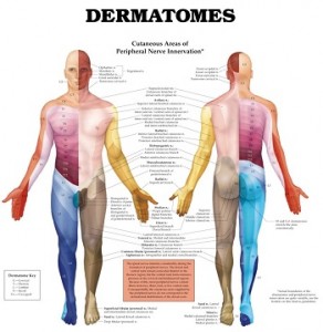Dermatomes can be useful in diagnosing nerve pain