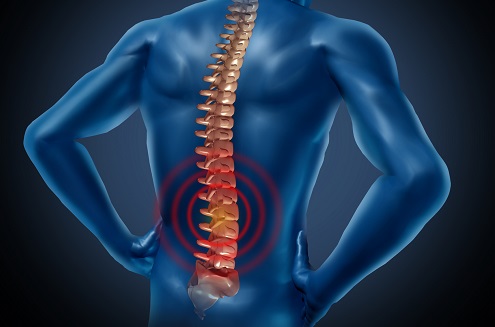 Chronic Lower Back Pain - Lumbar fusion is not the solution