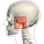 TMJ or TMD - TemporoMandibular Joint Disorder