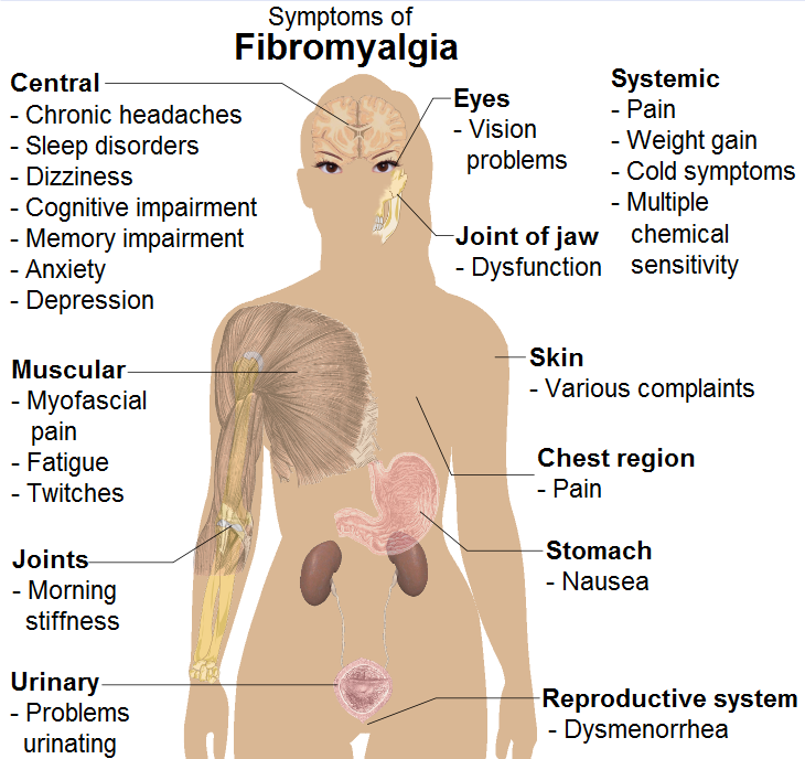 fibromyalgia Symptoms