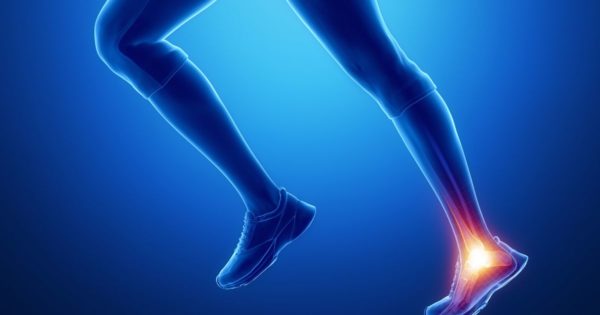 Achilles Tendonitis - 10 things NOT to do