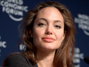 Bells Palsy - Angelina Jolie was a famous sufferer