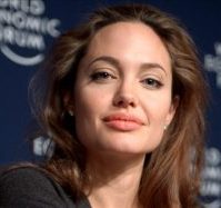 Bells Palsy - Angelina Jolie was a famous sufferer