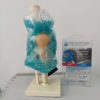 Therapearl - knee Bodyworks Clinic Marbella